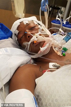 Elijah McClain is pictured in hospital after being fatally injured during his arrest in Aurora, Colorado, in August 2019. Three officers and two paramedics have now been charged.