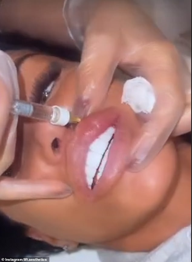 Katie shared a video of herself getting her lips pumped up with filler