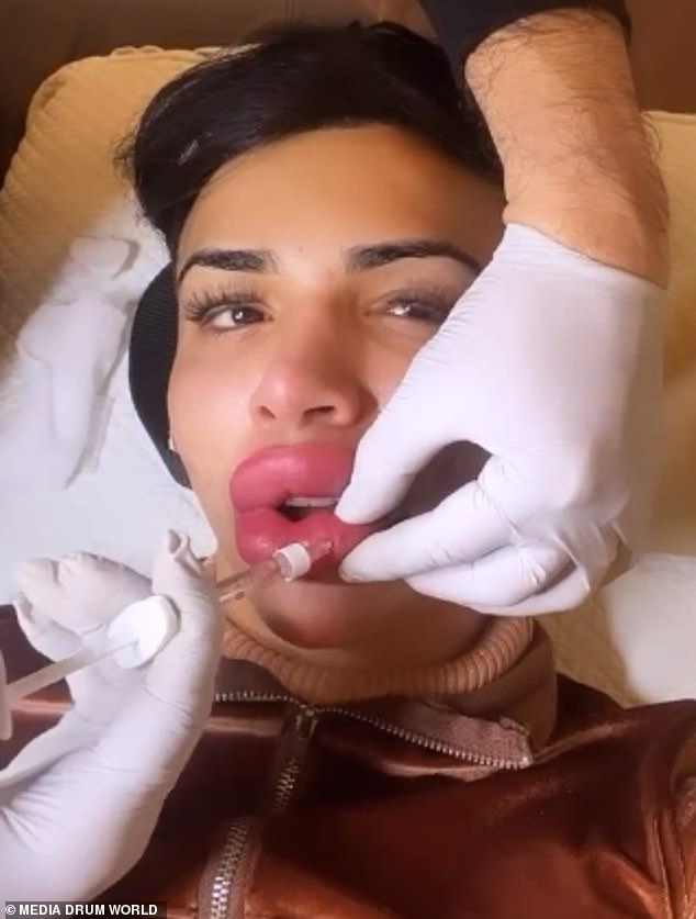 Angel has had 16 different surgeries and with their 25cc XL lips they claim to have the largest lips in Florida