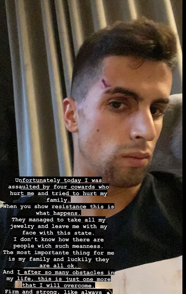 Manchester City defender Joao Cancelo was attacked by intruders at home when he tried to stop them taking jewellery.  He shared this image of his injuries