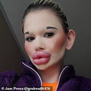 The former philosophy student started her transformation in 2018 and says she is not afraid that her lips will ever burst