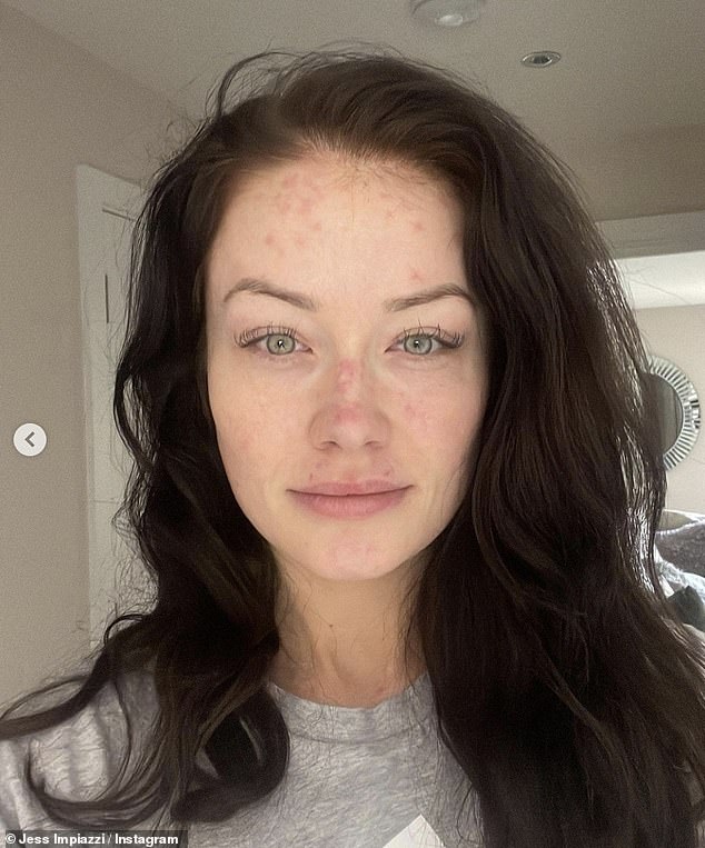 1704049254 255 Jess Impiazzi breaks her silence on her difficult year after