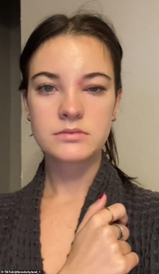 In the first video, Brooke Hyland, 25, said she woke up with an extremely swollen eye after popping a pimple near her eyebrow.