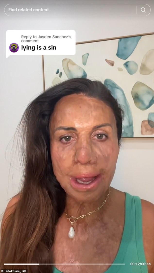 The athlete who suffered horrific burns to 64 percent of her body in a forest fire twelve years ago slammed the thoughtless hater in a stern TikTok video.