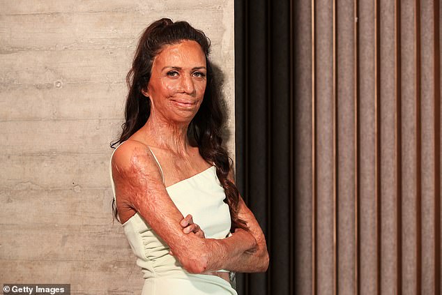 Inspirational burn survivor Turia Pitt, 36, (pictured) hit back at a vile online troll on Wednesday after they made a nasty comment about her appearance