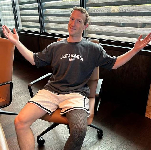 On Instagram, Zuckerberg updated the masses on his recovery from last month's knee surgery