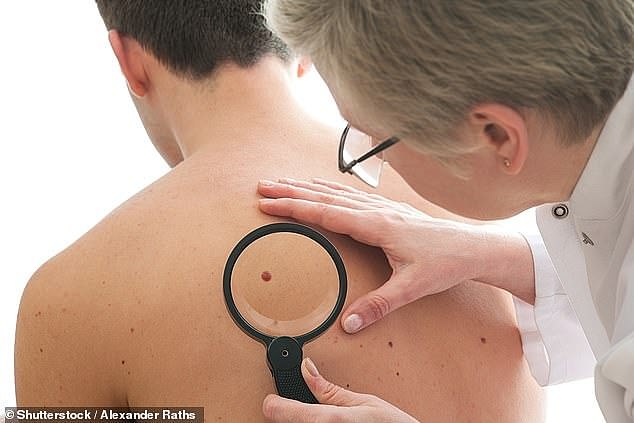 Most people would rather be assessed for skin cancer by artificial intelligence (AI) than wait to see a doctor in person, a study shows