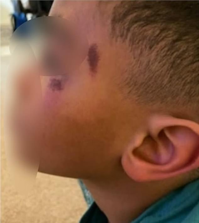 The parents of an eight-year-old disabled boy have filed a lawsuit against the Laramie County Sheriff's Department in Wyoming after claiming disturbing bodycam footage showed their son being assaulted by an officer.