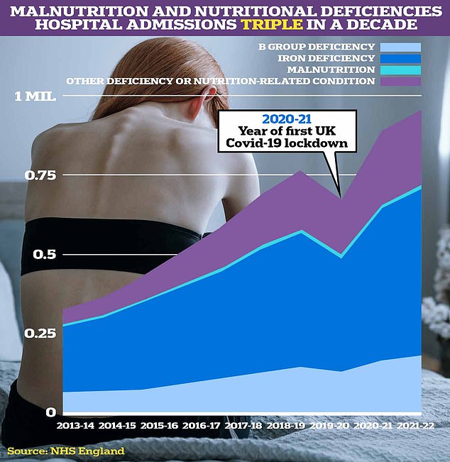 Official figures show that there were more than 800,000 admissions in England and Wales last year with conditions related to poor nutrition, including the 'Victorian' diseases scurvy and rickets.  Iron deficiency was the biggest problem, NHS data showed, with admissions for the bone-weakening condition rising by 149 percent since 2013.