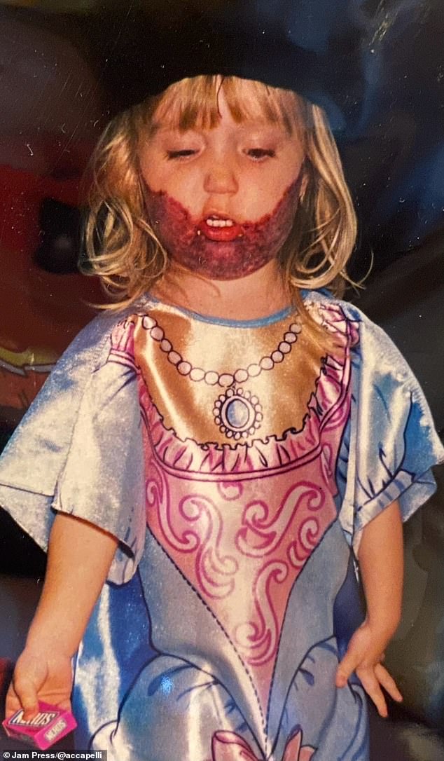 Michigan native Danielle Lipple, now 28, has had a large port-wine stain, also known as a vascular malformation, since she was a young girl (pictured)