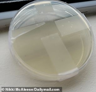 After five days, no more bacteria had grown on the petri dish containing samples from the metal band