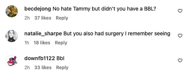 Meanwhile, questions resurfaced about whether Hembrow had undergone a Brazilian butt lift (BBL), with one asking: 'No hate Tammy, but didn't you have a BBL?'