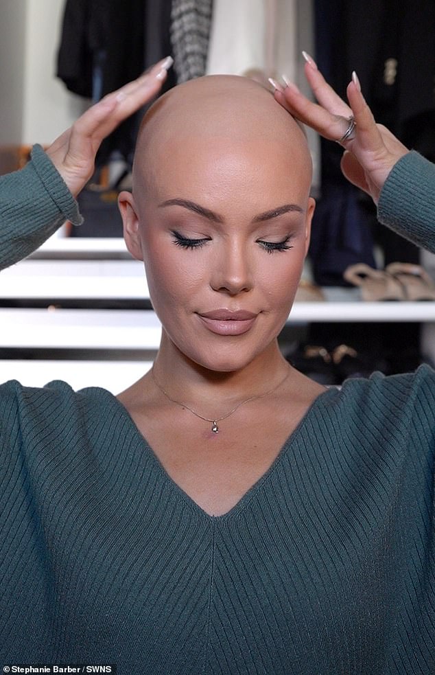 After working up the courage to go to the doctors, she was diagnosed with non-scarring alopecia