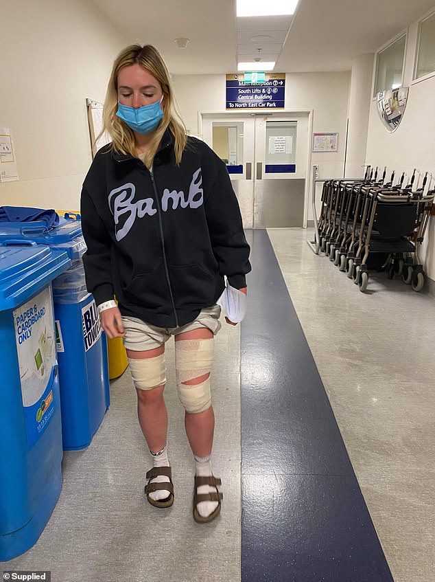 The 22-year-old went to the emergency room after returning to Melbourne.  Nurses drained the blisters and she left with bandages on both legs (photo)