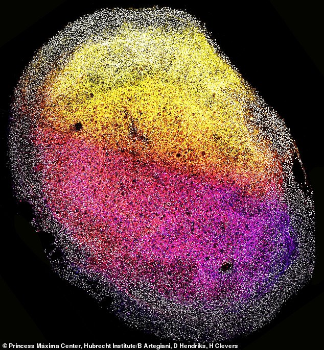 The mini-brain (shown close-up) is about the size of a grain of rice and can be multiplied for future research efforts