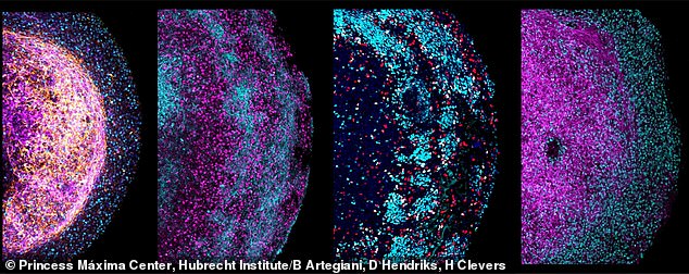 Four zoomed-in images of parts of different human fetal brain organoids.  Several neural markers are colored, depicting their cellular heterogeneity and architecture