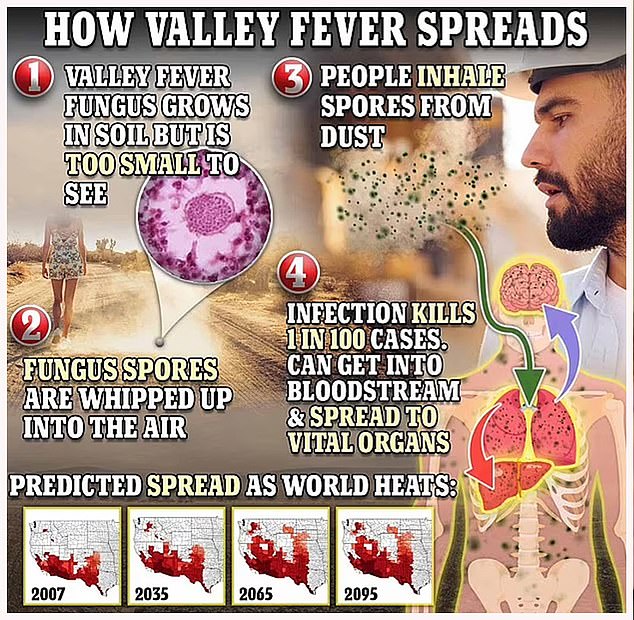 Valley Fever is believed to affect at least 20,000 Americans each year and in worst cases can cause fatal meningitis