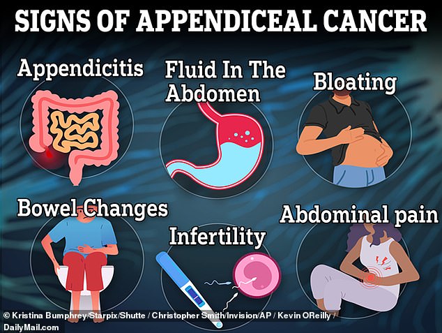 The above image shows the symptoms of appendix cancer.  Doctors discover a mysterious increase in the number of cases of the disease