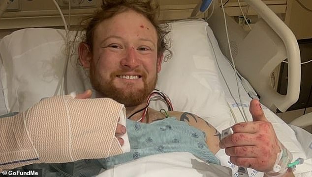 Reum is seen lying in bed, smiling, with one hand giving a thumbs up while the other is wrapped in a plaster cast as he recovers from broken bones