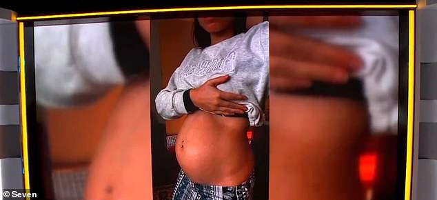 The young expectant mother said that her pregnancy is very rare.  'No one really saw it.  “All the ultrasound people had been working in the field for about 30 years and they've never seen it,” she said