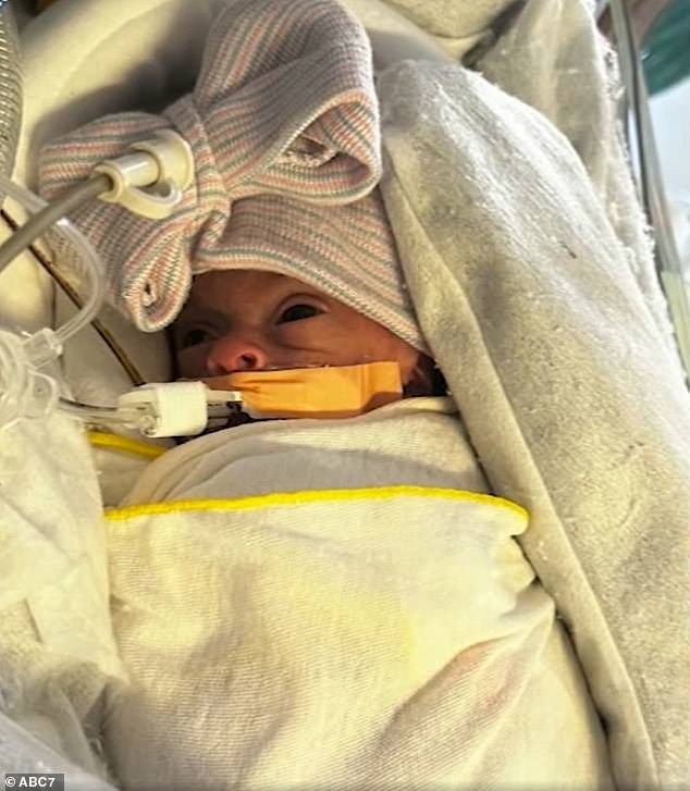 But after twenty weeks, Ellyanna could no longer get proper nutrition through her umbilical cord and doctors ordered Juarez to undergo an emergency caesarean section.