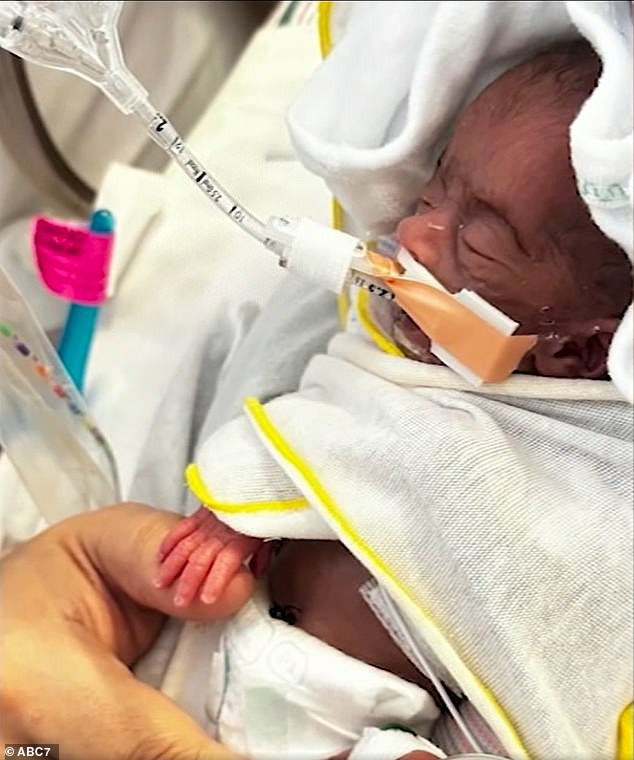 Ellyannah nearly died during her first month of life and was the first baby at Cedar-Sinai Medical Center in Los Angeles to use a special high-frequency jet ventilator