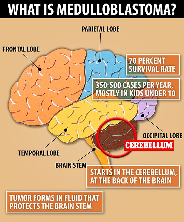 Medulloblastoma is a form of brain cancer that starts in the cerebellum, which is located at the back of the brain and controls movement and coordination.  It accounts for 350 to 500 cases per year, but is the most common form of brain cancer in children