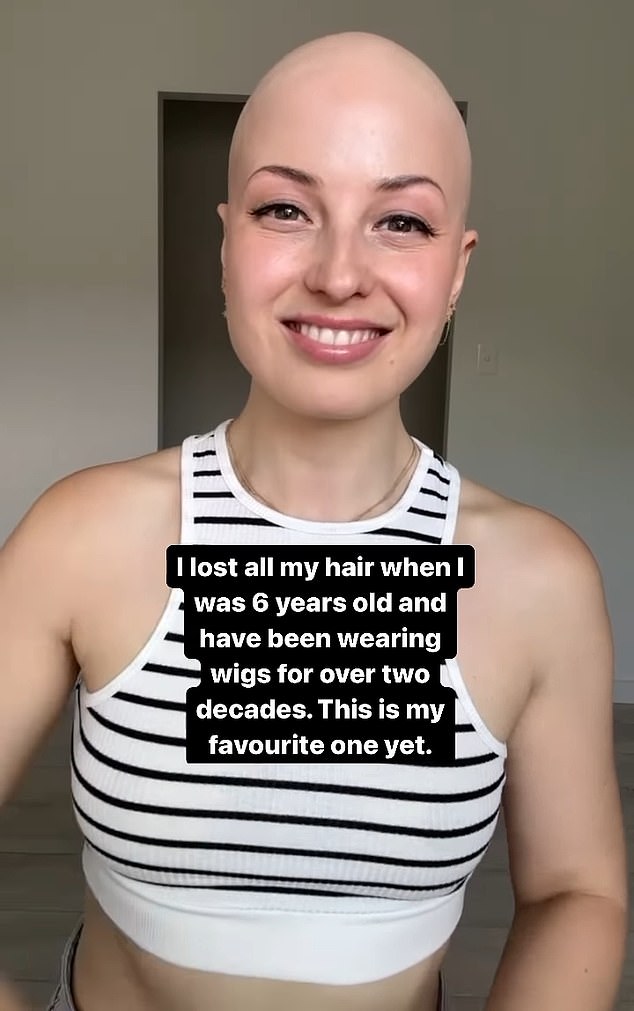 Holly works with Lusta Hair and can often be seen on their social media, sharing her own alopecia journey or helping young women choose the perfect wig