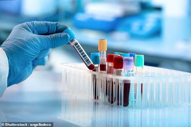 The new blood test looks for circulating fragments of cancer DNA.  Lower levels mean the cancer is getting smaller and the treatment is working.  A higher level shows that the treatment is not working