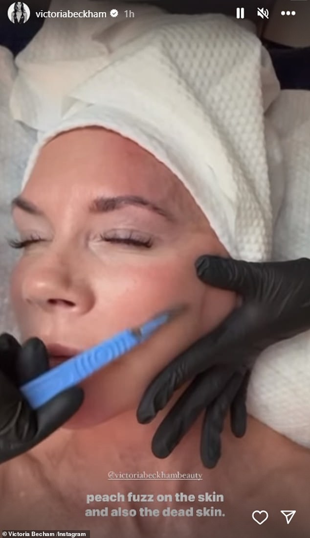 She also underwent a section of dermaplaning to remove dead skin cells and 'peach fuzz' from her face