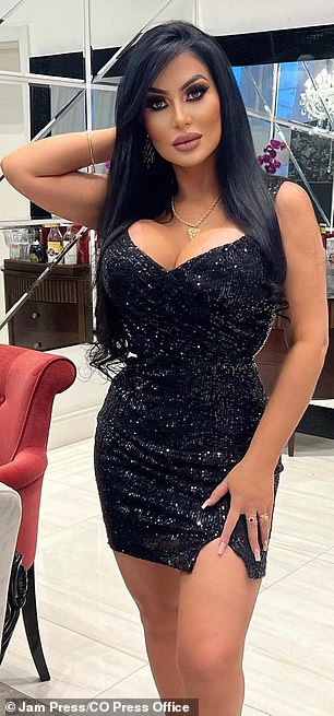 Ana Paula Oliveira, who is also a model and influencer, spent $500,000 on plastic surgery to look like Kim Kardashian.  In the photo: Ana after the operation