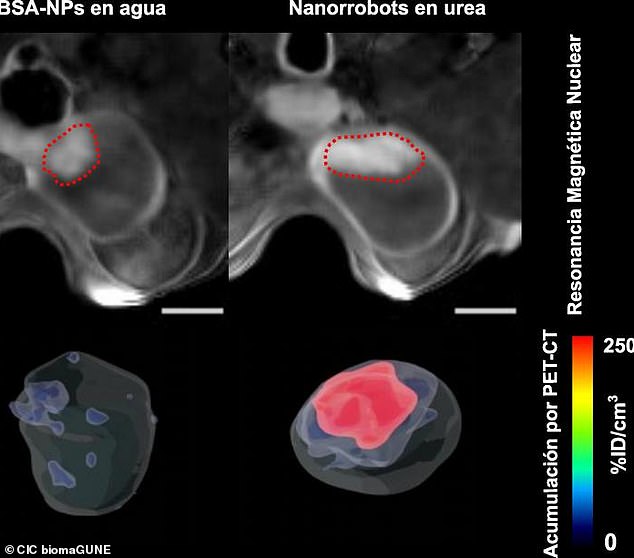 The nanorobots located the tumors and moved in to directly administer radioactive iodine to shrink the tumor