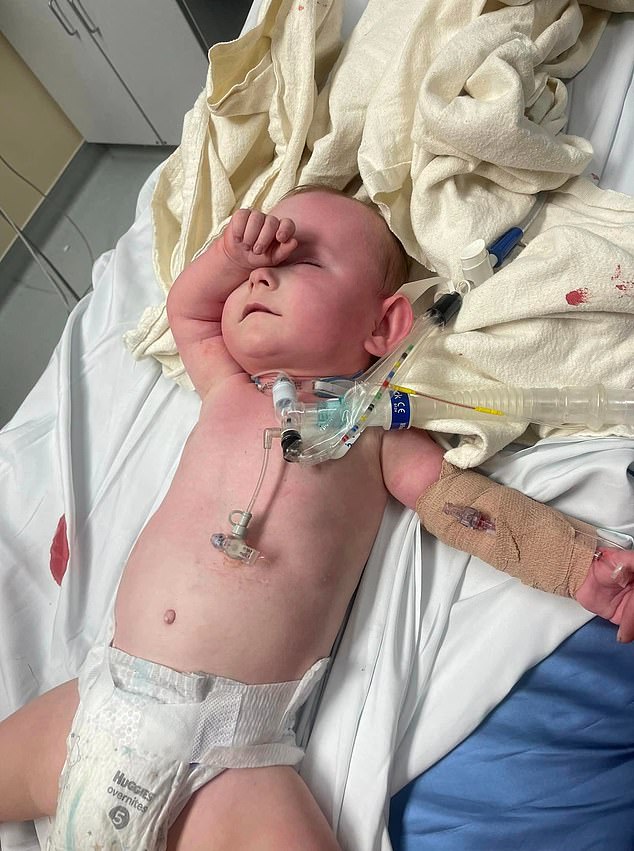 The baby in the ICU.  Price said before the incident, her child had begun to make some health progress, but is now fighting to survive the new trauma he has endured.