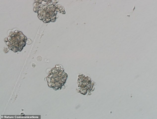 Close-up view of the inner cell mass of the monkey SCNT blastocysts – the clusters of dividing cells made by a fertilized egg