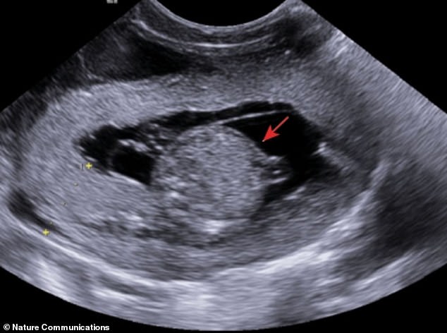 Ultrasound examination of the rhesus fetus on day 60 of gestation (the average gestation period for the species is 165 days)