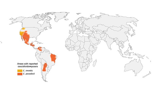 The above shows the presence of valley fever infections all over the world.  Valley fever is most common in California, Arizona, Nevada, New Mexico and Utah