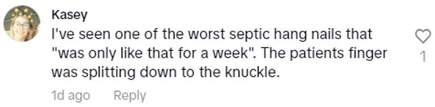 In the comments section of her video, many admitted that they had problems with gel manicures or had even switched to getting dip powder manicures.