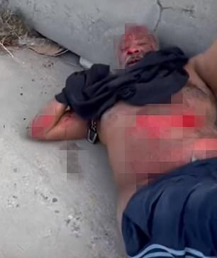 Video also showed his skin being ripped off from his arms, stomach and legs