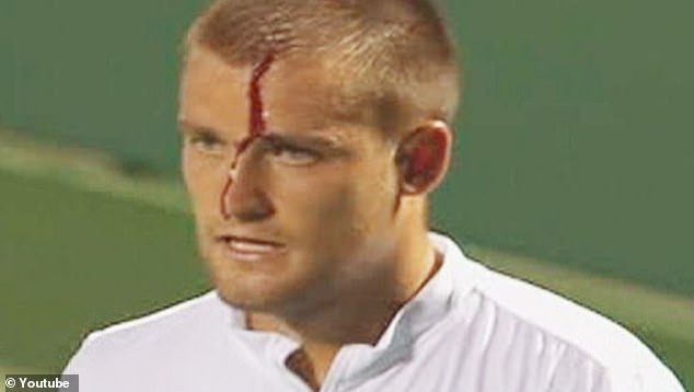 He became a global sensation in 2008 after drawing blood by hitting a racket on his forehead during a match at the Miami Open (pictured)