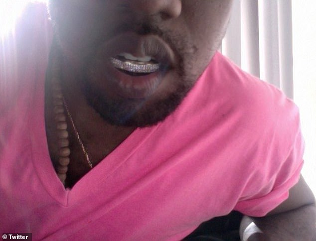 Kanye has worn a grill before, showing off a diamond-encrusted set on his bottom row of teeth on social media