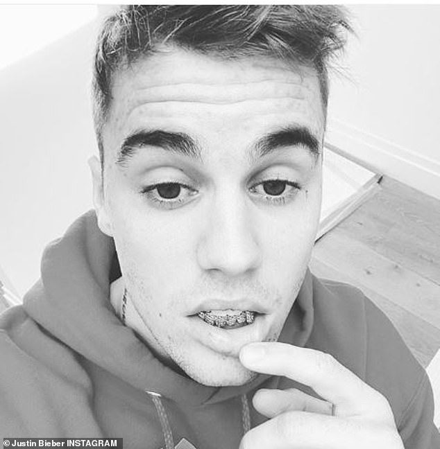 Justin Bieber is one of the stars who have worn a grill before