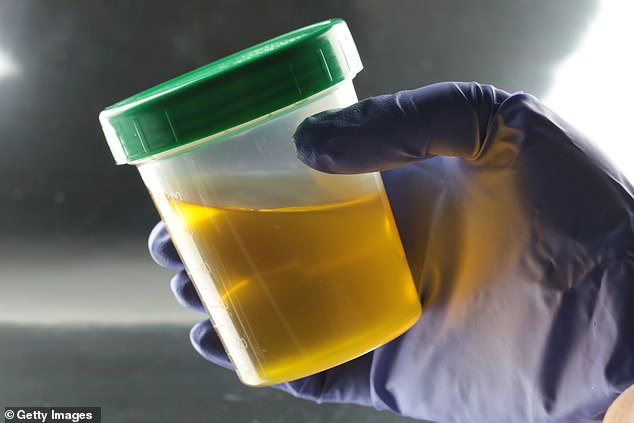 The use of dog urine instead of human urine in drug tests will be flagged 'immediately' by labs, according to health experts (stock image)