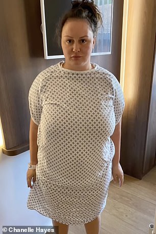 After tipping the scales at 17 stone, Chanelle explained that her weight loss had left her breasts deformed, making her look like she had 'four boobs'.