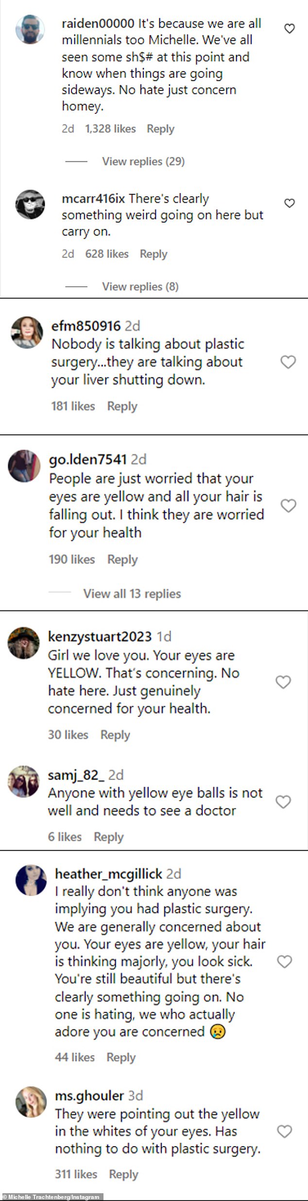 Instagram user @heather_mcgillick wrote: 'I honestly don't think anyone was suggesting you had plastic surgery.  We are generally concerned about you.  Your eyes are yellow, your hair is thinning, you look sick