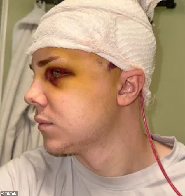 The New Yorker was rushed to hospital after surgery in September during which he suffered a post-operative site infection under his artificial skull.