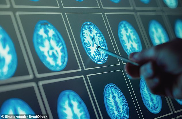 Research from the Brain Tumor Research Center of Excellence, part of Imperial College London, found they could identify traces of the disease in standard blood samples (Image)