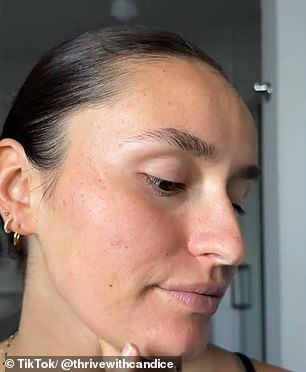 Candice also shared photos showing red pimples along her jawline before she started dry brushing, and photos afterward showing her skin looking brighter (pictured)