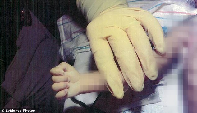 Paramedics were shocked to see that the baby was so thin that his 