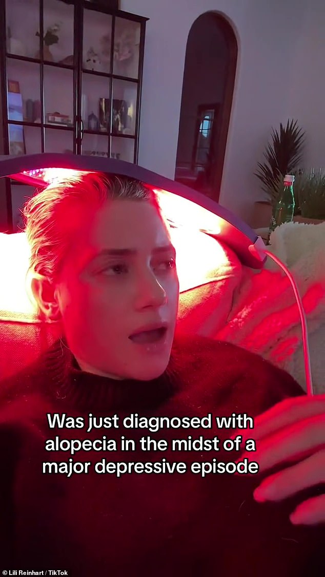 Red light therapy is my new best friend,” she added, along with hashtags for “alopecia” and “mental health”