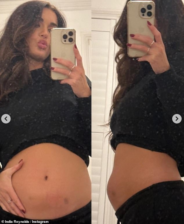 She opened up about her fertility journey, showing off her bruises and swollen stomach, and admitted last year that she felt like she had been 'punched in the stomach'